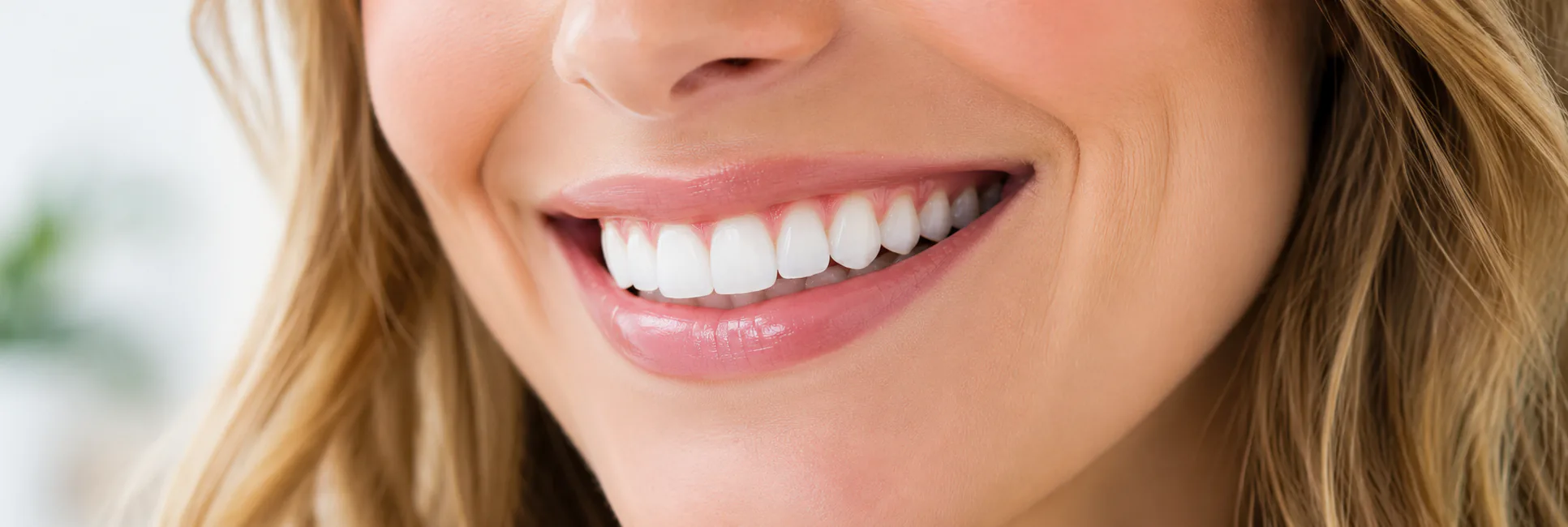 A close-up of a smile with bright, evenly shaded teeth after whitening