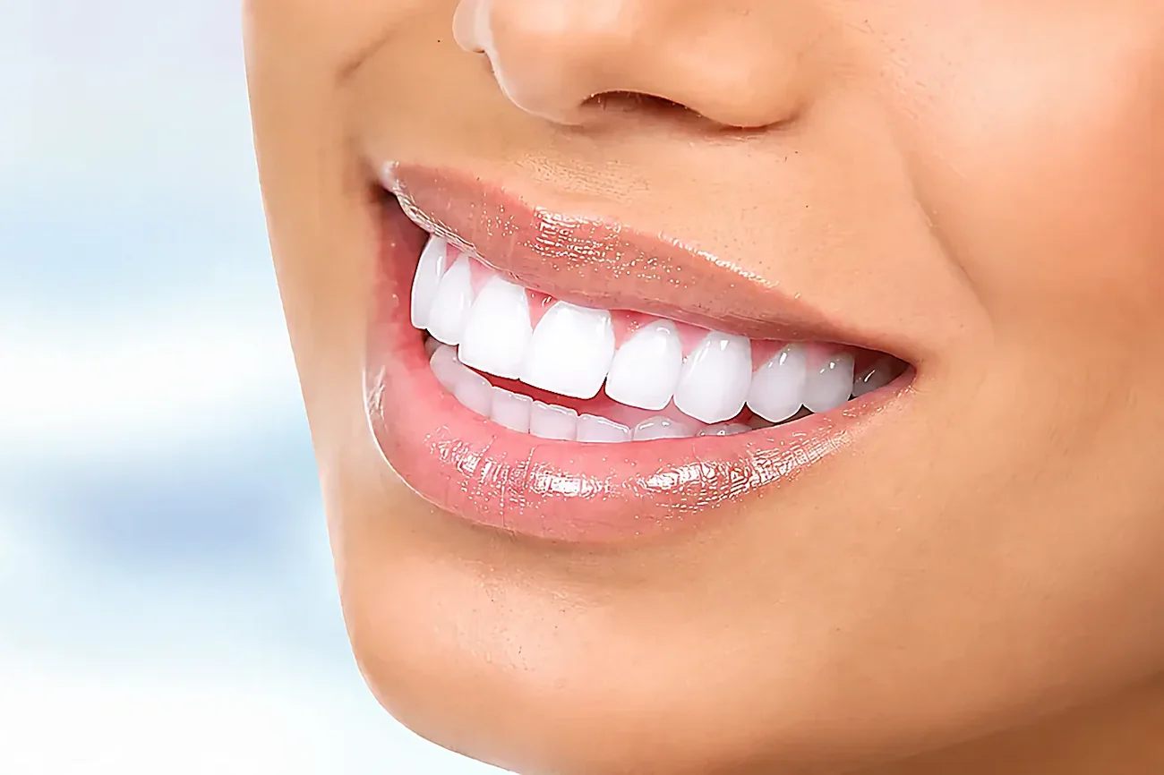 A close-up of a smile with white teeth