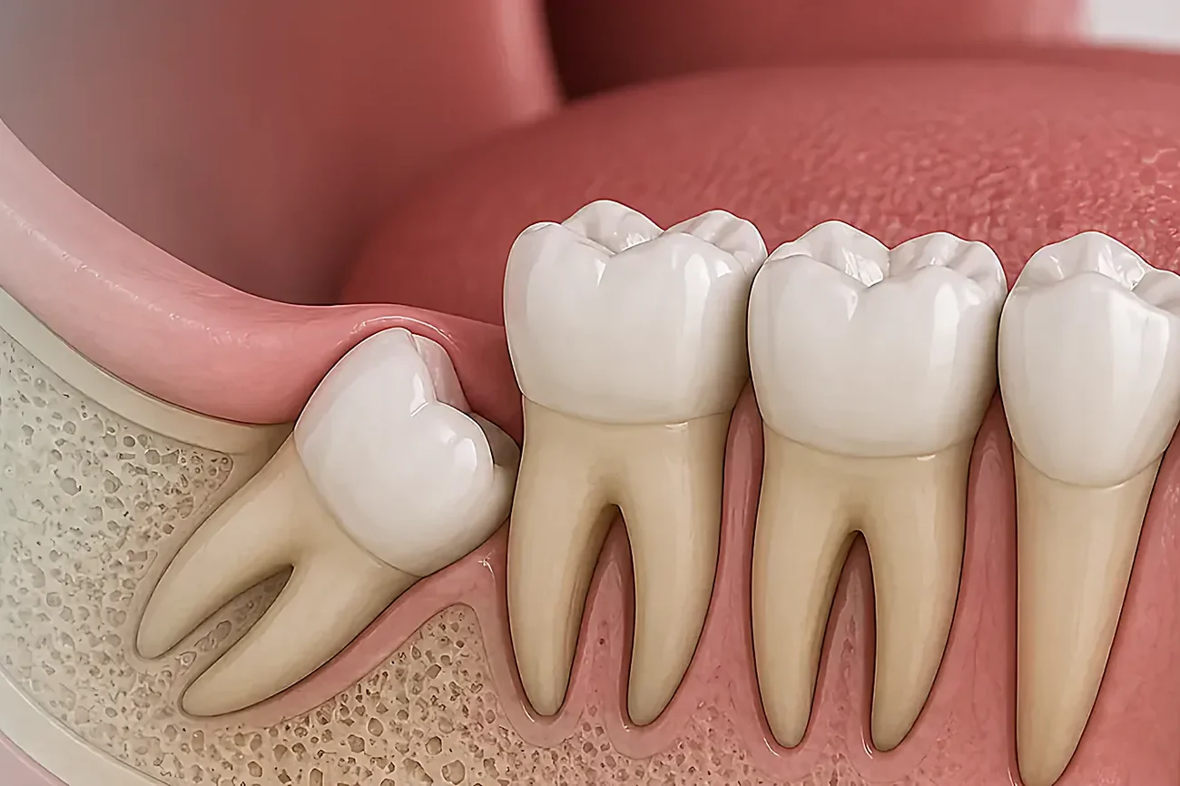 A model of the lower molars showing the gum line