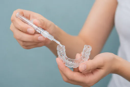 Hands filling a clear whitening tray with gel from a syringe