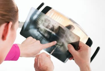 How to Get Your Child Ready for Wisdom Teeth Extraction