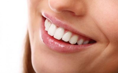 Smile Makeover: The Top 5 Cosmetic Dentistry Procedures for a Brilliant Smile