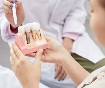 Replacing a Tooth with a Dental Implant