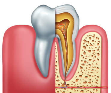 Restoring Your Oral Health Through Root Canal Therapy